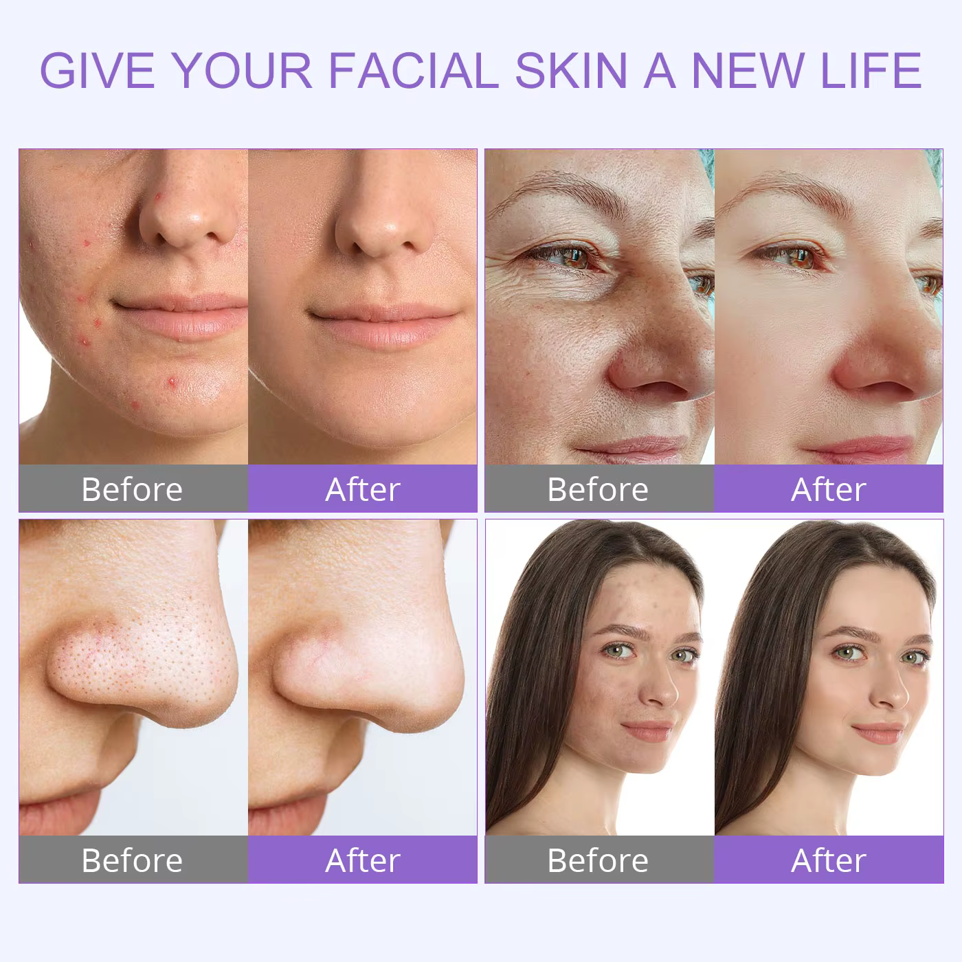 DermDelhi-Machine Hydro-Eau à Oxygène Professionnelle pour Soins de la Peau, Jet Peel Oxy Spray, Liv