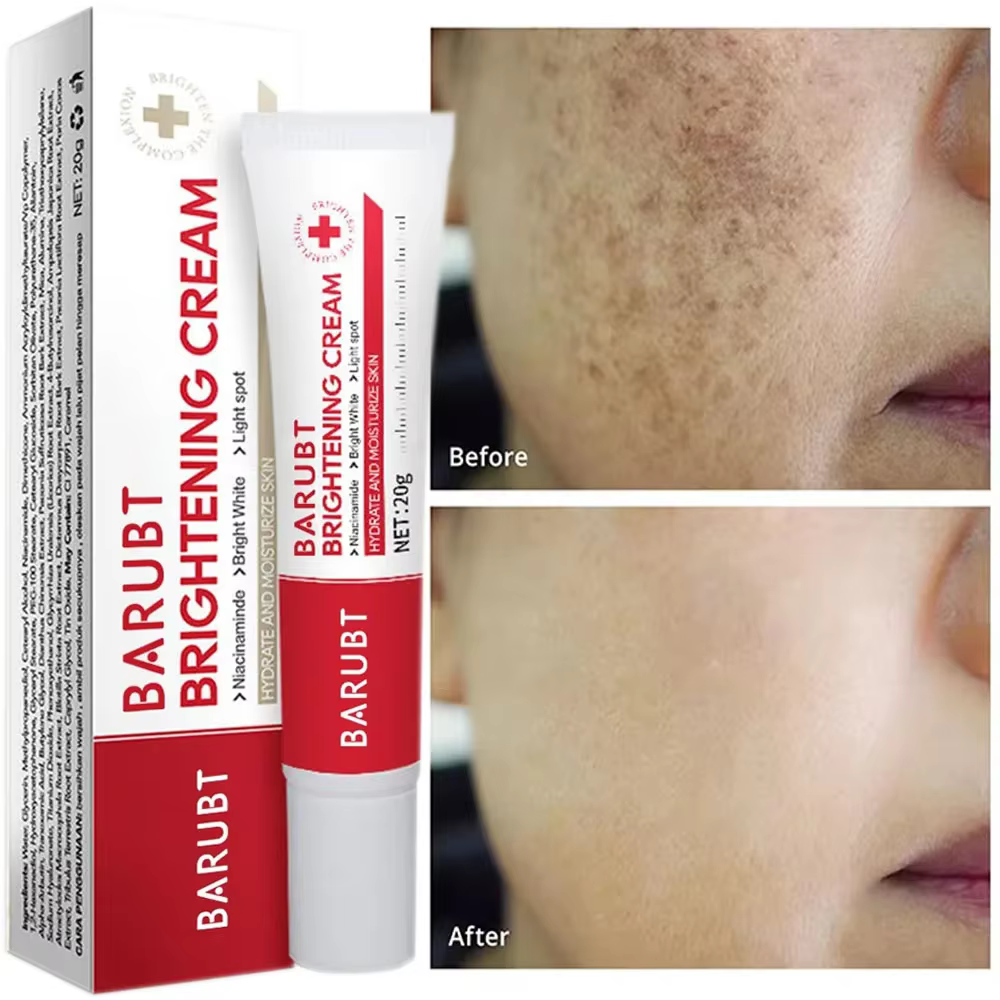 Crème blanchissante pour le visage, élimination des taches de rousseur, Melasma, correcteur de tache