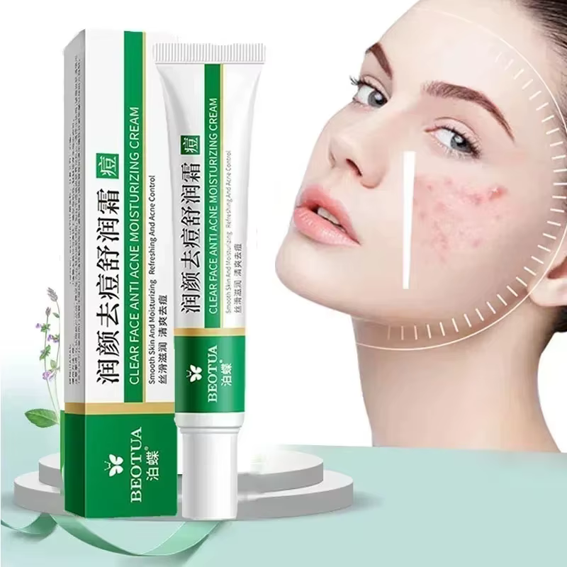 Crème de traitement de l'acné à base de plantes, gel réparateur pour les cicatrices du visage, élimi