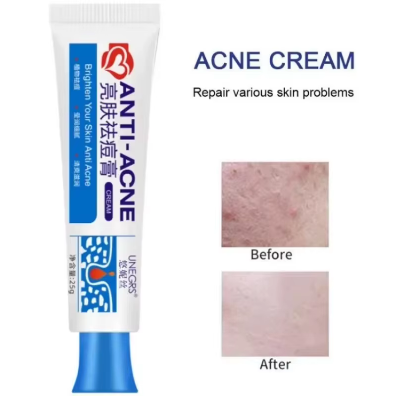 Crème Visage Anti-Acné à Base de Plantes, Gel Traitant les Cicatrices d'Acné et les Points Noirs, Ré