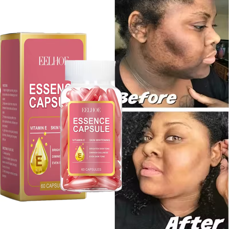 Capsule dissolvant de taches foncées de vitamine E Visage taches de rousseur mélanine correcte Ant