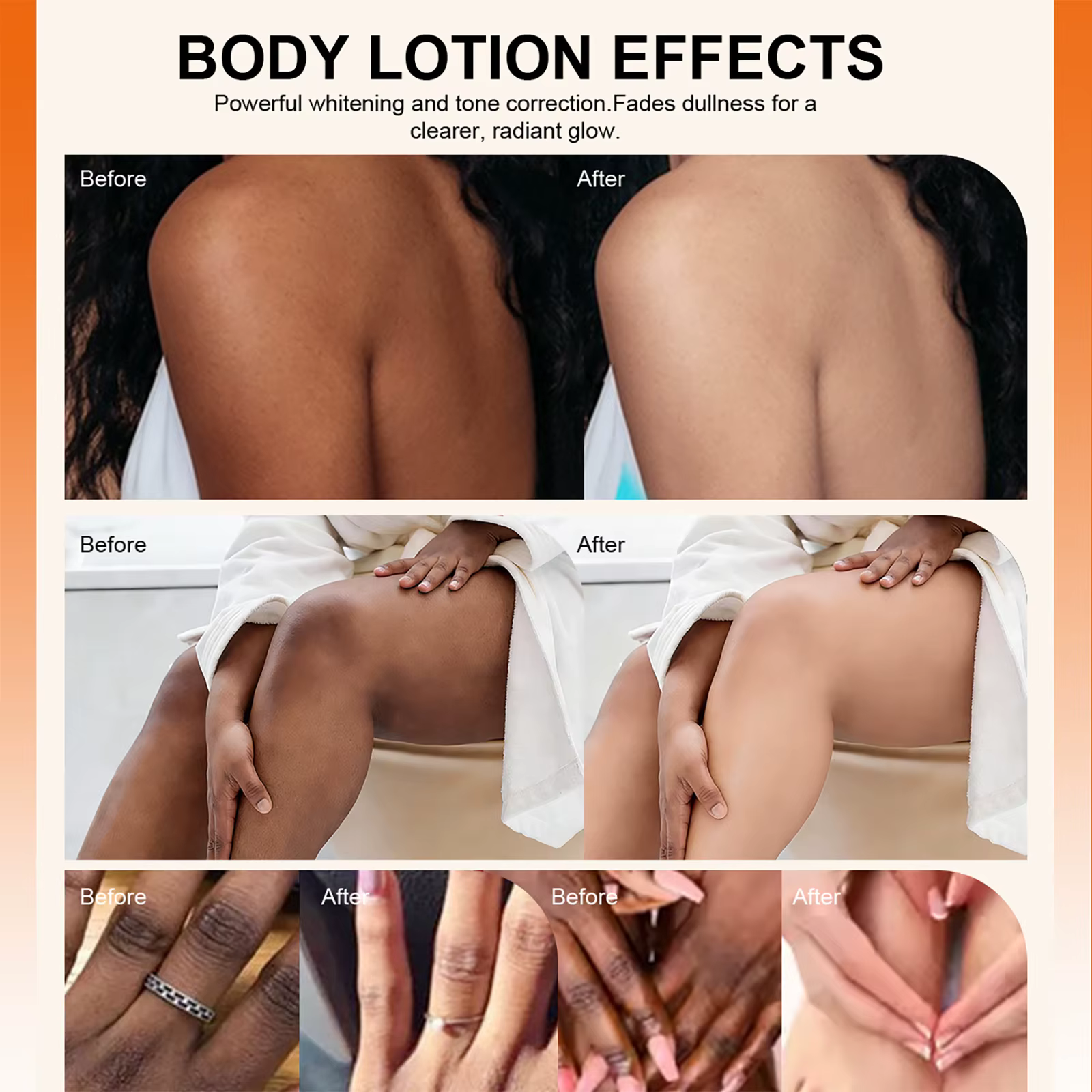 Lotion éclaircissante à l'arbutine LKIAE pour le visage et le corps, réduit les taches, nourrissante