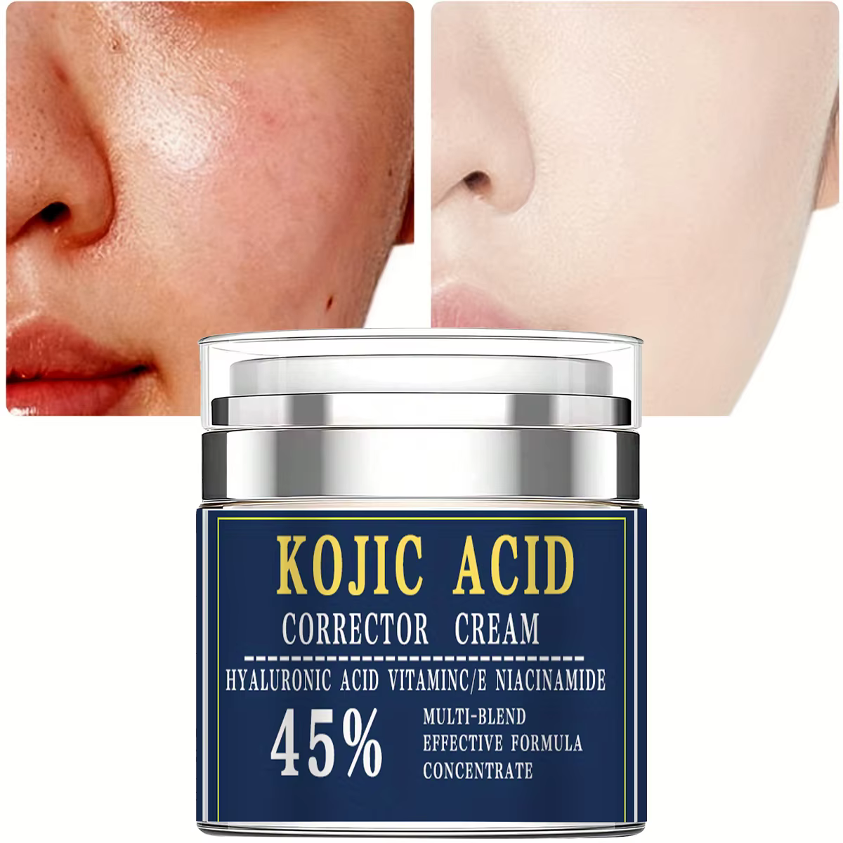 Crème à l'acide glycolique avec 15% crème liftante et raffermissante pour le visage hydrate et hydra