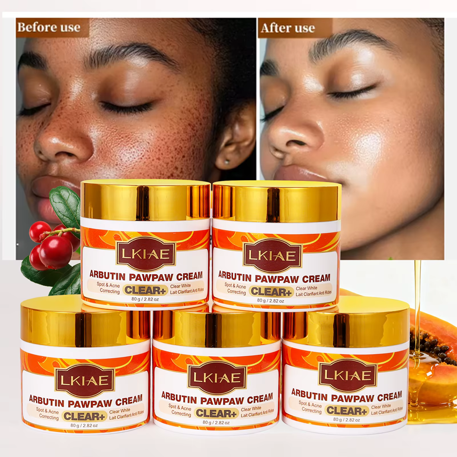 Crème visage LKIAE Arbutin Pawpaw pour femmes, correction des taches noires et de l'acné, éclairciss