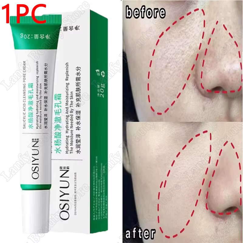 Crème de nettoyage des pores à l'acide salicVAC, rétrécit les pores, élimine les points noirs, l'acn