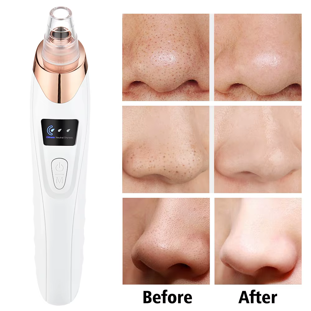 Dissolvant de points noirs pour le nettoyage du visage, machine de beauté à 3 modes d'aspiration, di