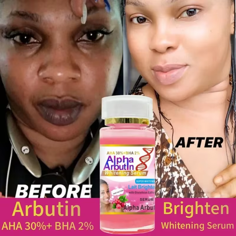 120 ml SUPER AHA 30% + BHA2% Alpha Arbutin X 3 sérum visage éclaircissant au lait avec la glutathion