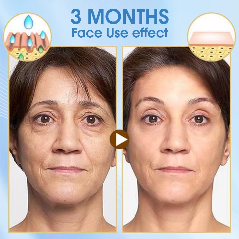 Coenzyme Q10 crème de jour Anti-âge Anti-rides crème de nuit ensemble combiné vitamine E crème hydra