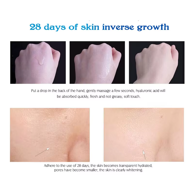 ARTISCARE sérum à l'acide hyaluronique VC Essence crème pour le visage hydratante acné vieillissement et réparation des rides 10 pièces