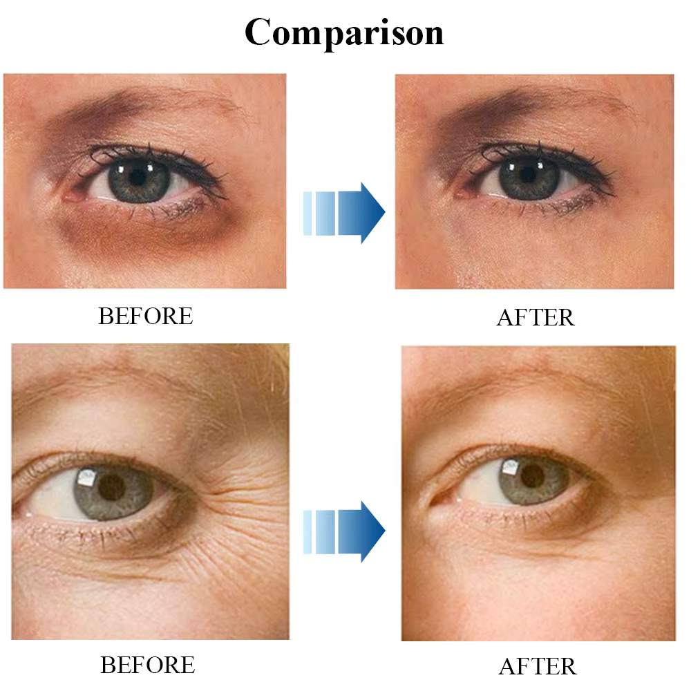 Crème anti-déformable pour le visage et le cou