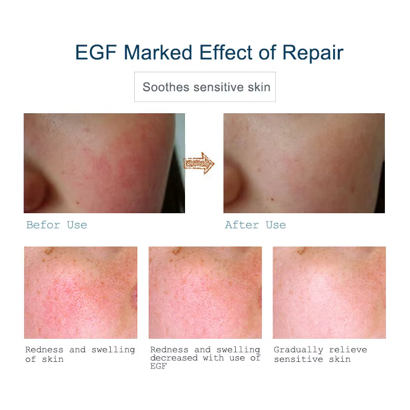 ARTISCARE EGF – sérum pour le visage