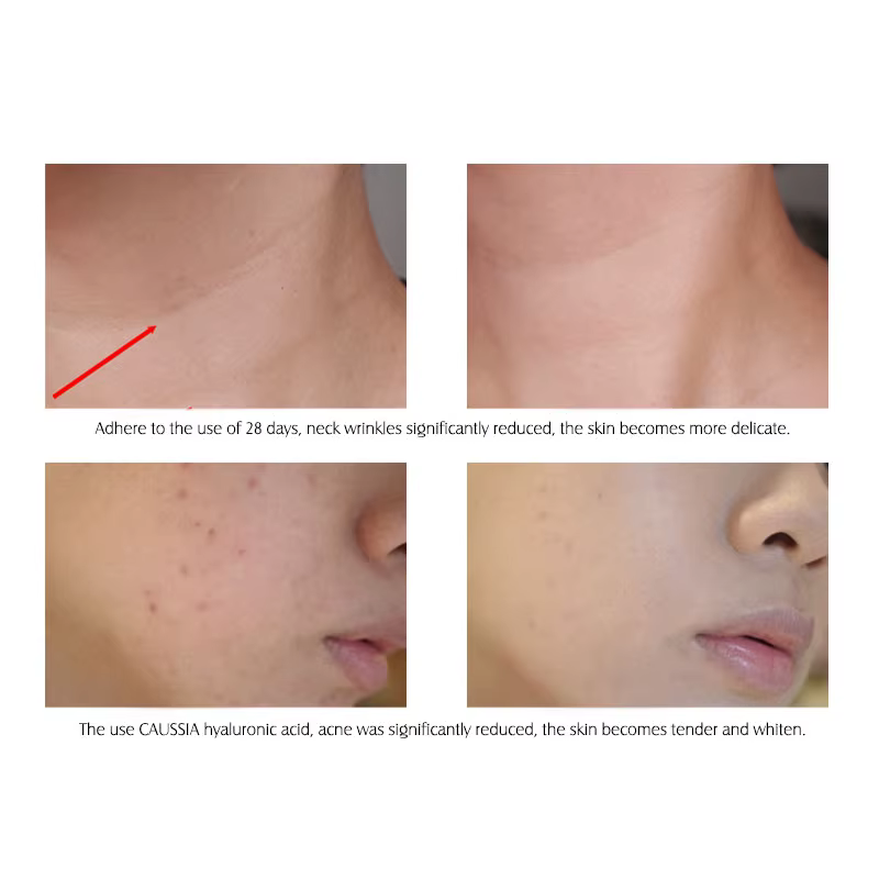 ARTISCARE sérum à l'acide hyaluronique 10 pièces/lot pour le visage hydratant
