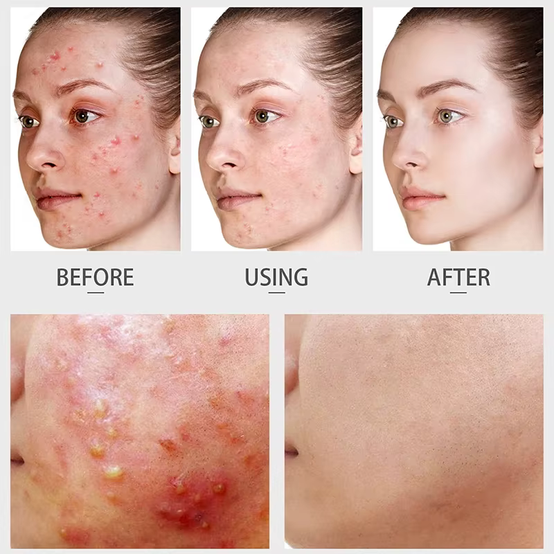LAIKOU – sérum pour le visage au thé vert
