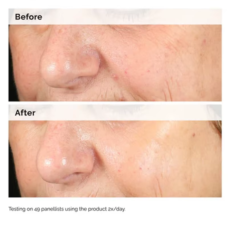 Alpha Arbutin 2% + HA 30ml Sérum Minimise L'apparence des taches foncées et de décoloration Hydrate la peau blanchit