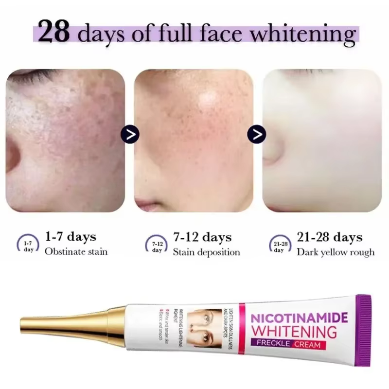Crème éclaircissante douce à la niacinamide pour la peau