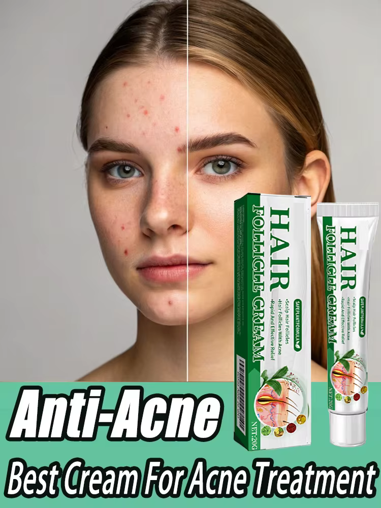 3ème crème Anti-acné efficace élimine les Nodules de la peau Pustules Cysts Papules points noirs hommes et femmes acné