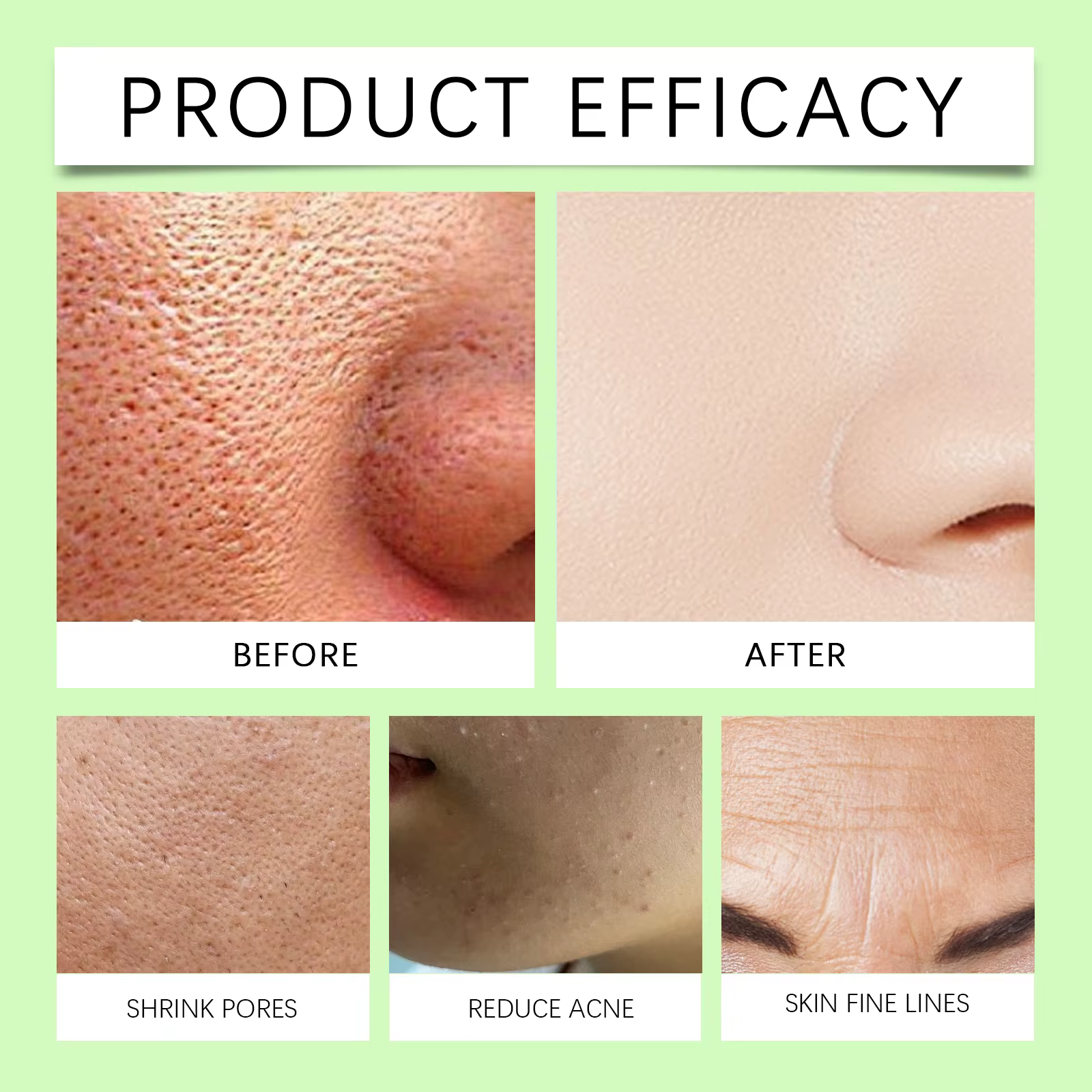 Essence de traitement des pores du visage