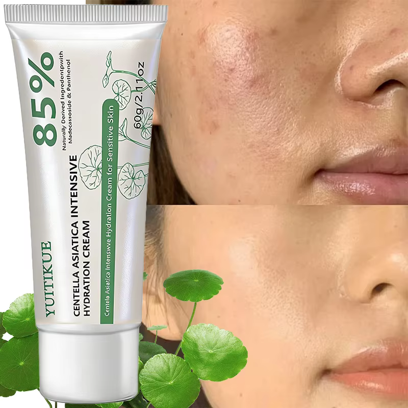 Crème hydratante intensive YUITIKUE 85% Centella Asiatica | Apaisant et hydratant pour les peaux sensibles | 60g