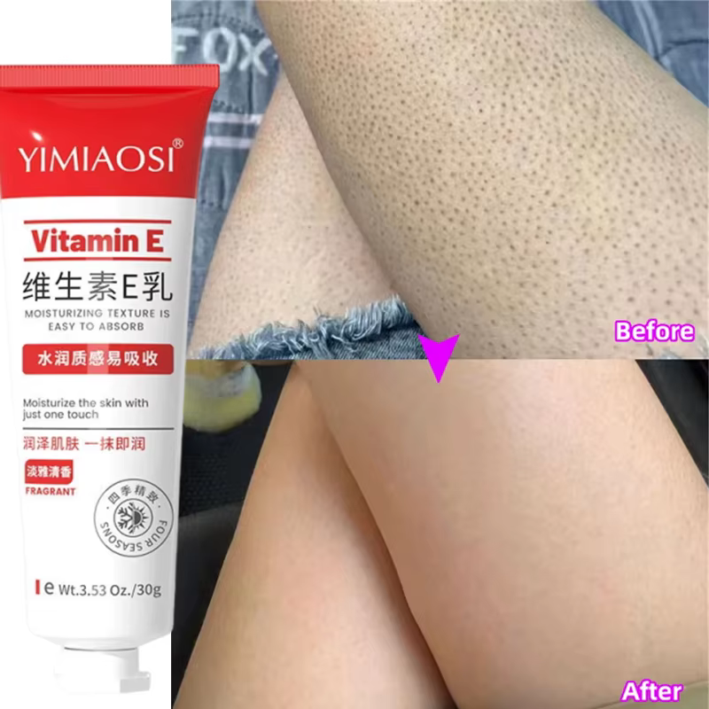 Crème Éclaircissante Vitamine E Anti-Mélanine pour Peaux Foncées – Efficace pour Éclaircir les Cuisses et Zones Intimes