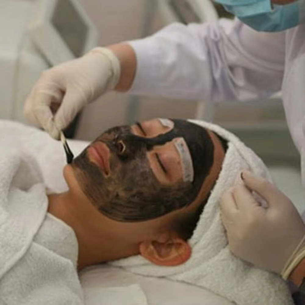 Crème de carbone noire pour poupée Laser douce