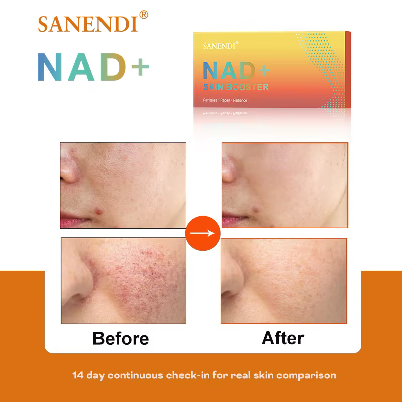 5 flacons NAD Plus sérum pour le lifting du visage NAD + PDRN Essence Dr.Pen