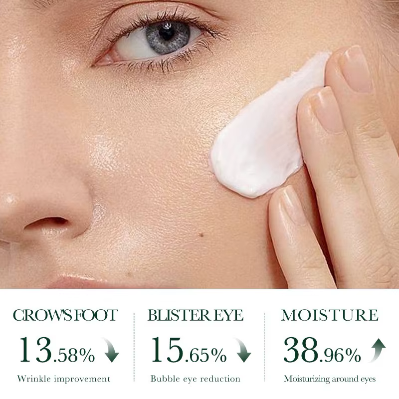 SADOER arbre à thé acné crème pour le visage Anti