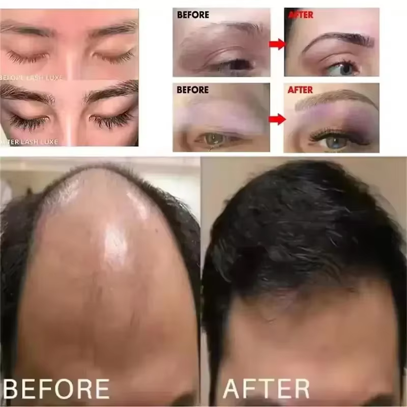 Sérum de croissance des sourcils 6ml – Traitement rapide pour des sourcils plus longs, plus fournis et plus épais à base d'Usma – Prévient la calvitie – Nouveau produit