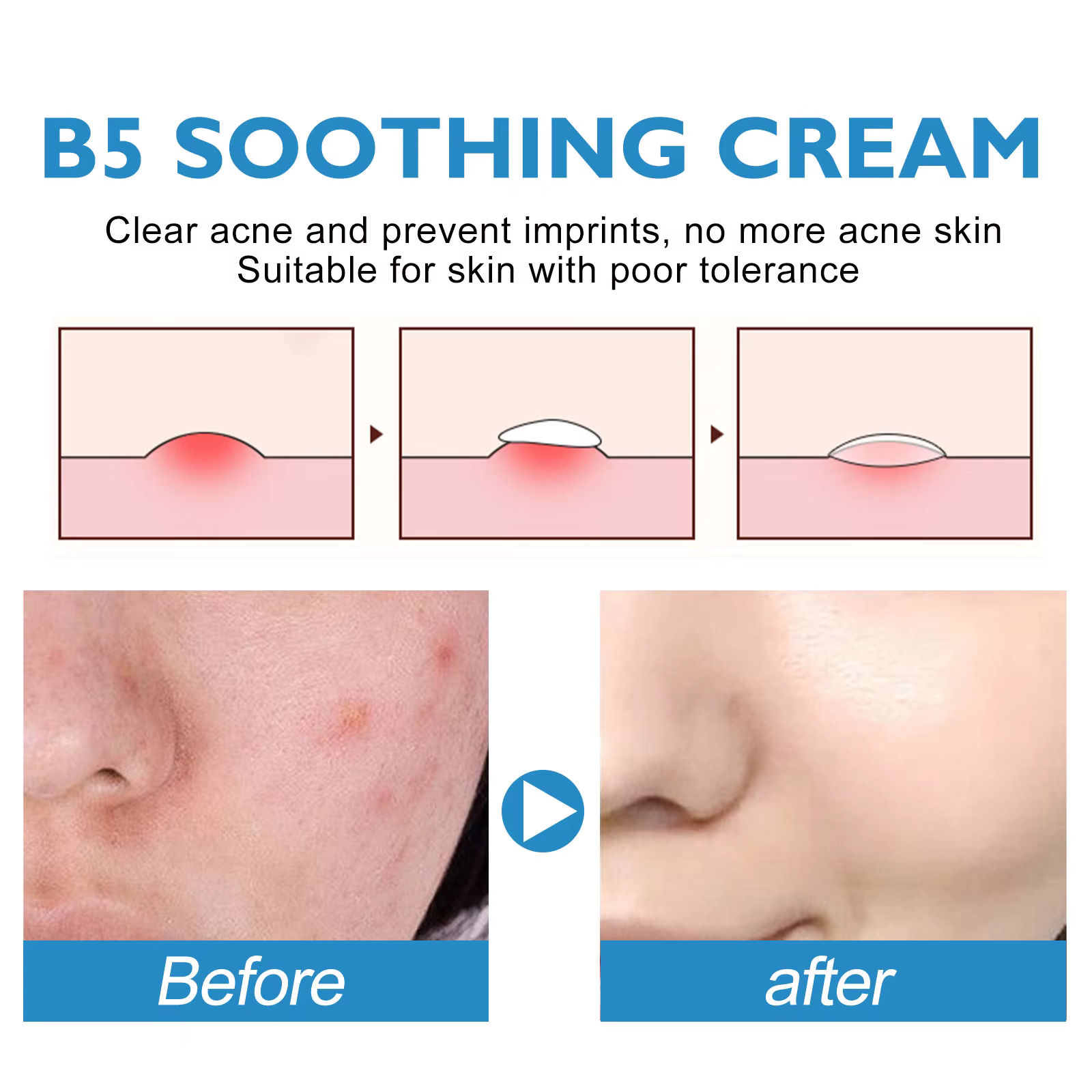 Crème Réparatrice B5 Hydratante Apaisante pour Peaux Sèches