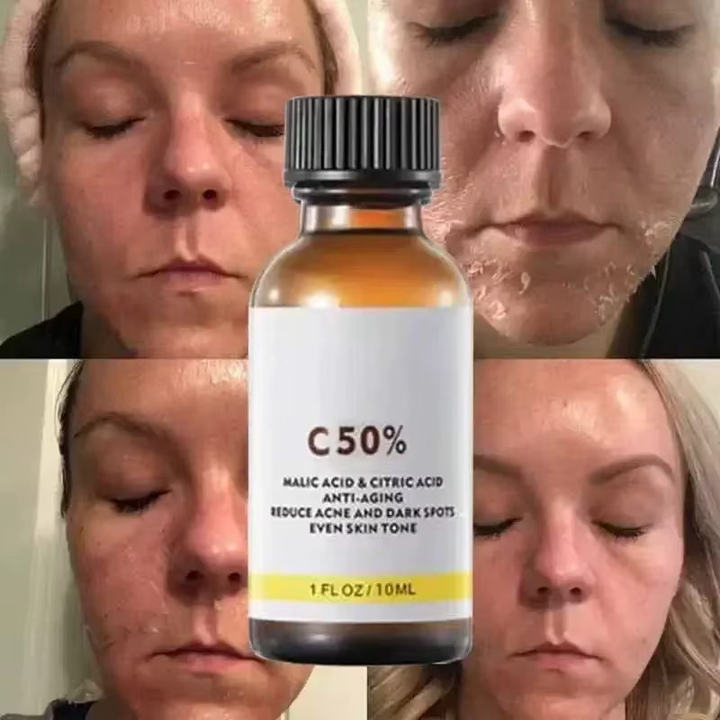 Mélanine de soins du visage pour une peau plus éclatante
