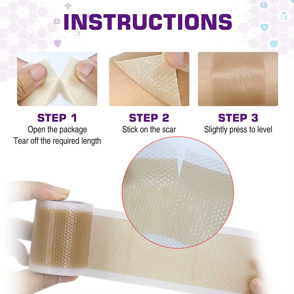 1 rouleau de feuilles de cicatrice en Silicone-grau médical
