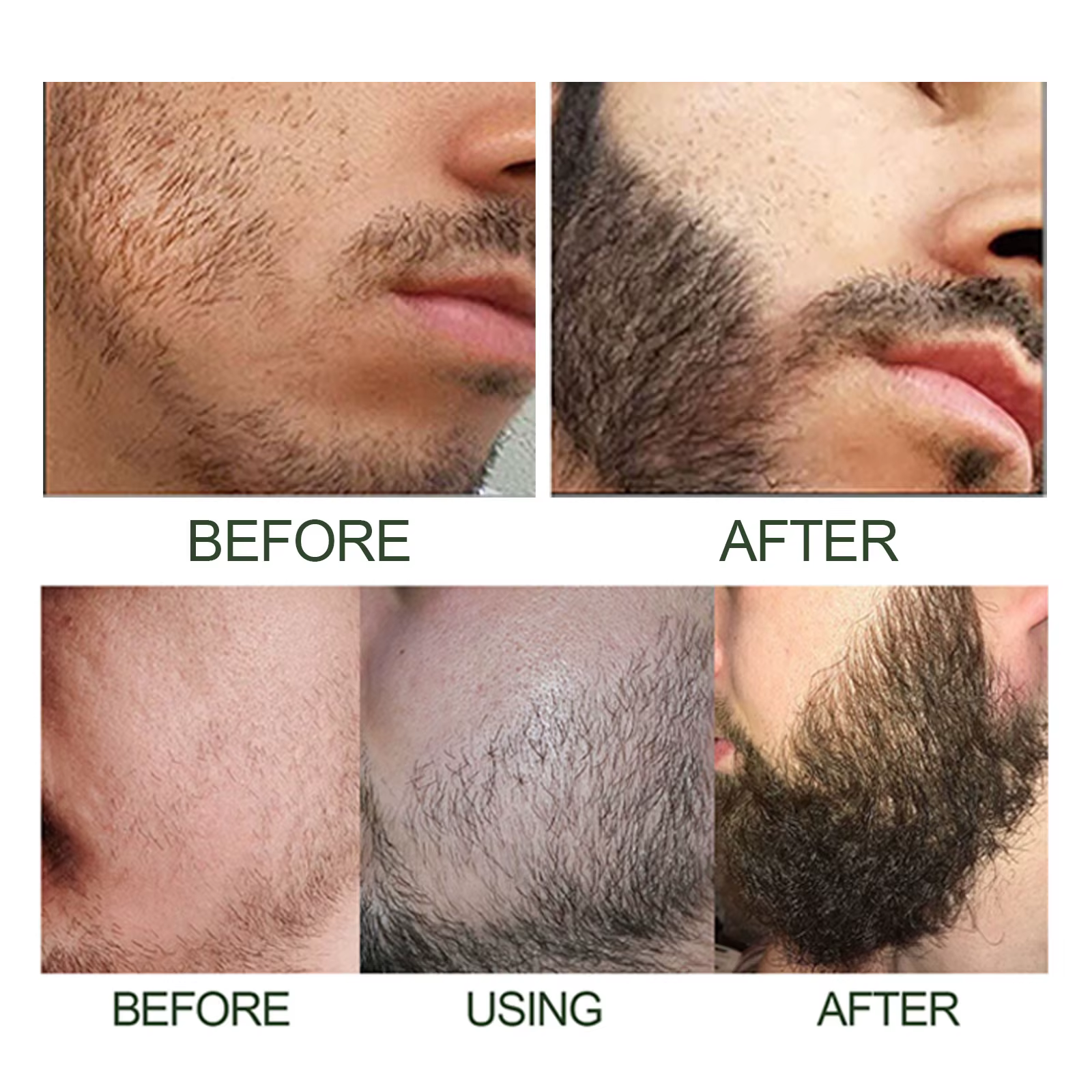 Kit de sérum pour la croissance de la barbe avec dermaroller 0