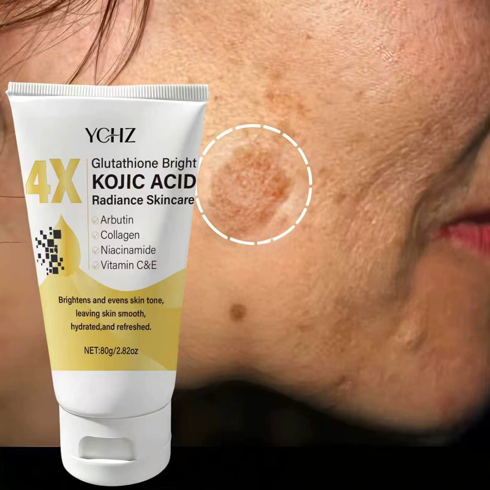 Crème pour le visage à l'acide kojique, unifie le teint, élimine les taches brunes et la terneur de la peau - Non grasse, convient aux hommes et aux femmes - Crème éclaircissante et hydratante, pour u