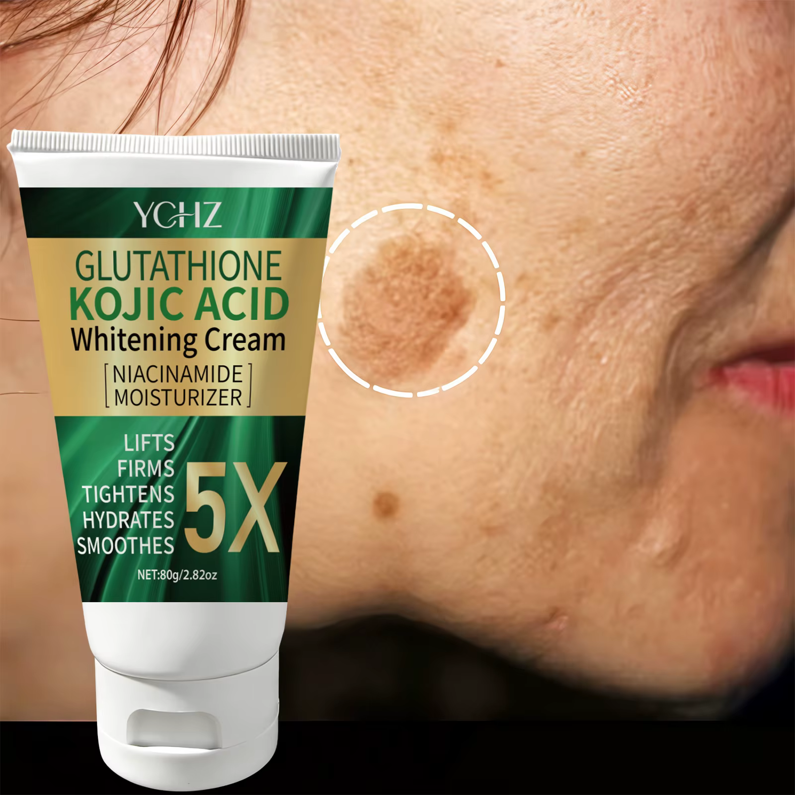 Crème pour le visage à l'acide kojique 5X
