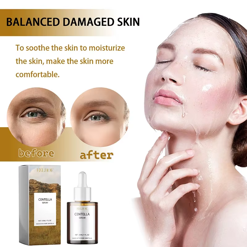 Centella Asiatica sérum pour le visage nourrir la peau sèche lissage rajeunissement