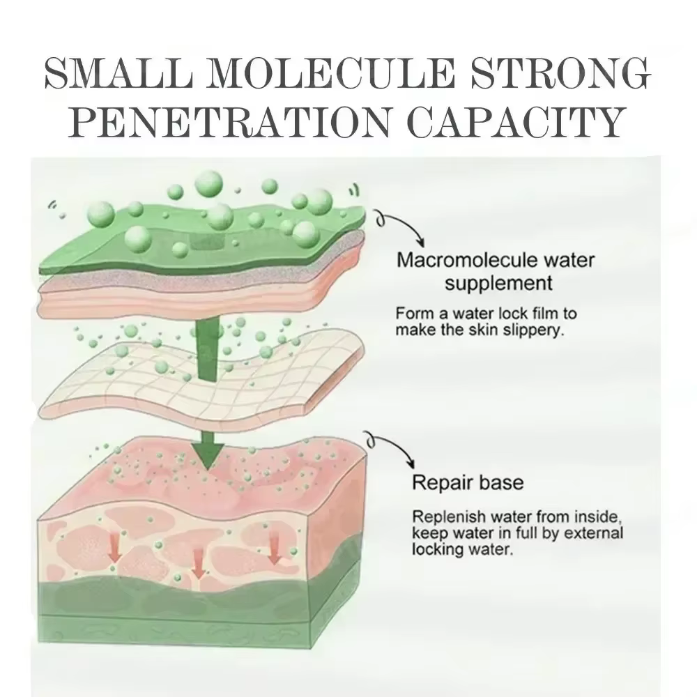 3ème crème Anti-acné efficace élimine les Nodules de la peau Pustules Cysts Papules points noirs hommes et femmes acné