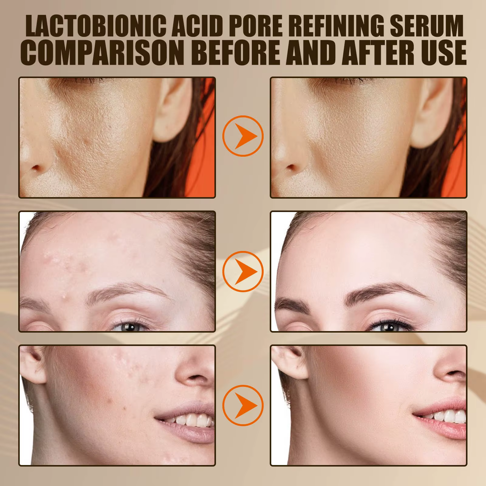 Acide lactose rétrécit les Pores sérum hydratant élimine les points noirs réparer