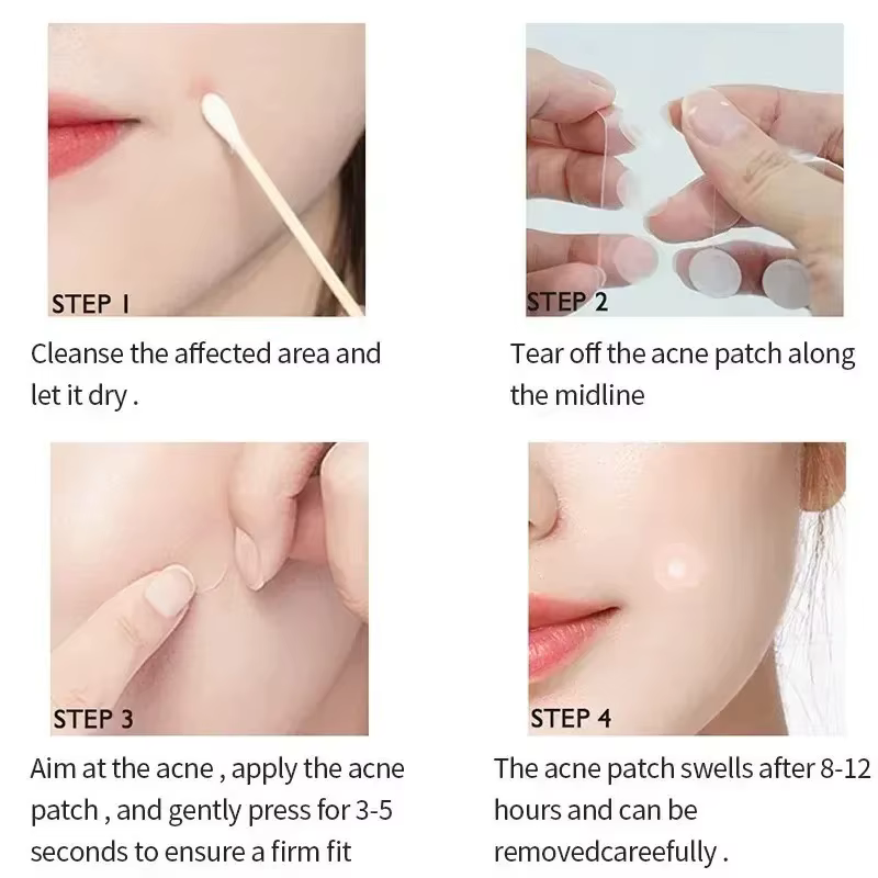 Réparation acné Patch soins de la peau du visage estompe les imperfections boutons marques fermées