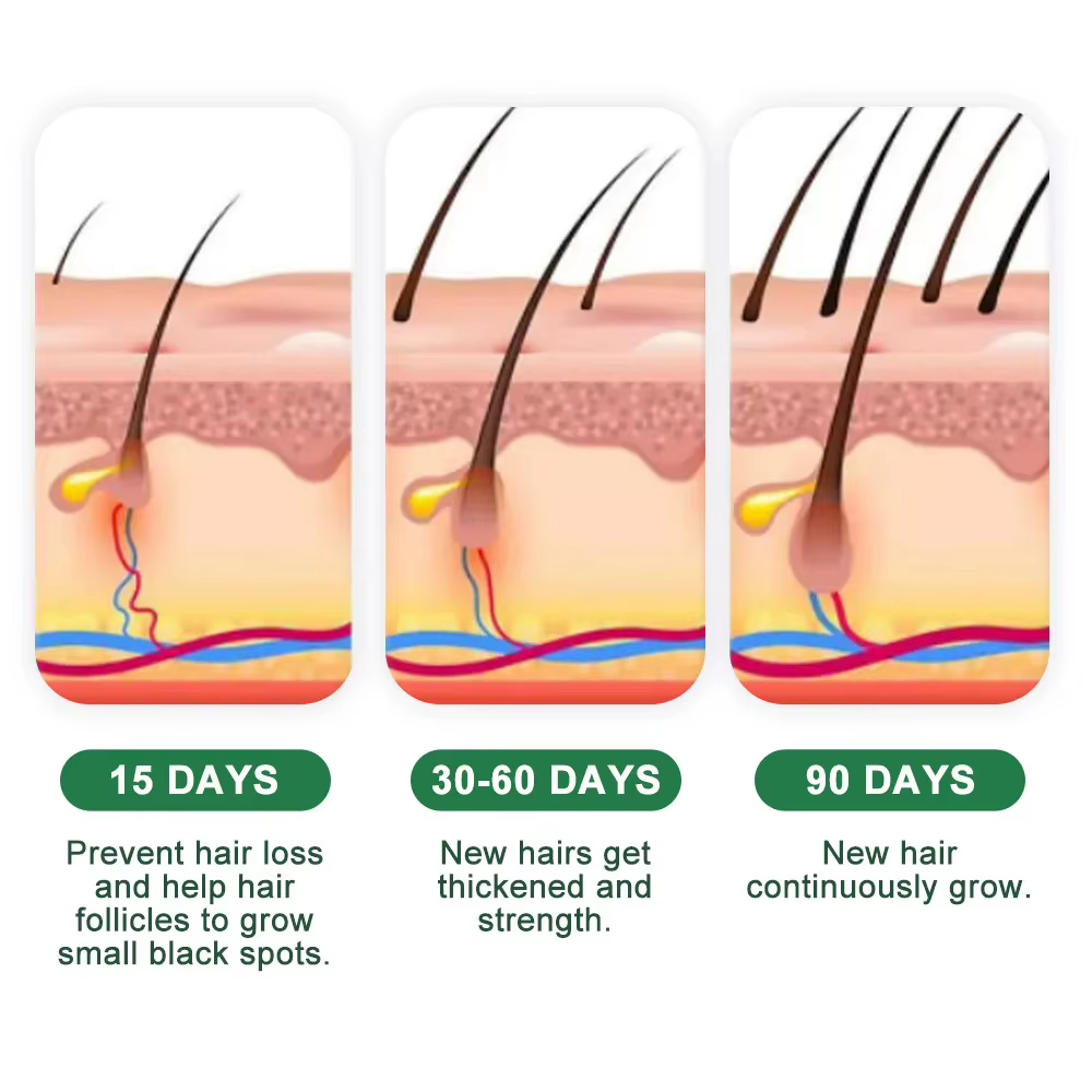 Crème de croissance des cheveux, Capsule essentielle pour une repousse rapide en 7 jours, Anti-chute de cheveux, réparation de la calvitie, traitement du cuir chevelu endommagé, pour femmes et hommes