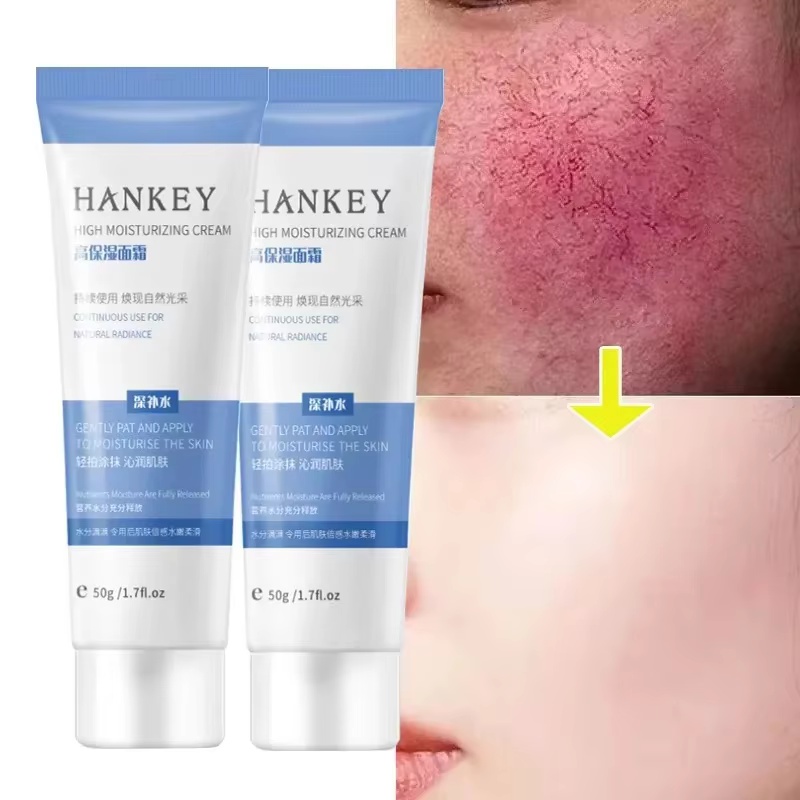 Crème Réparatrice Anti-Rougeurs Visage – Améliore la Peau Sensible et la Sécheresse – Hydratant Apaisant – Élimine la Rosacée – Cosmétiques Coréens