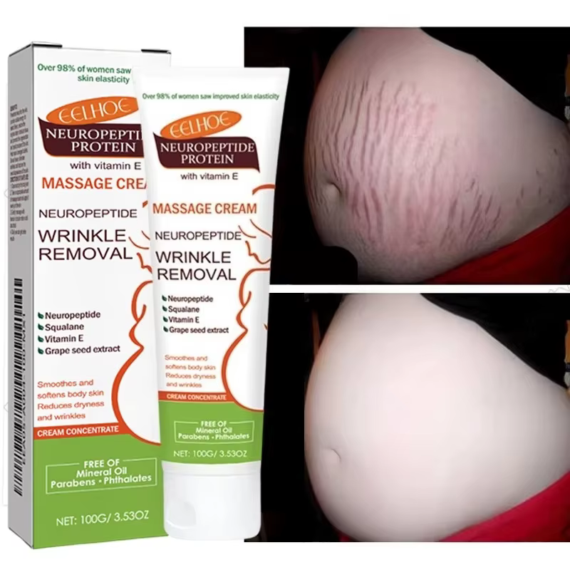 Crème anti-vergetures permanente 100g pour femmes enceintes