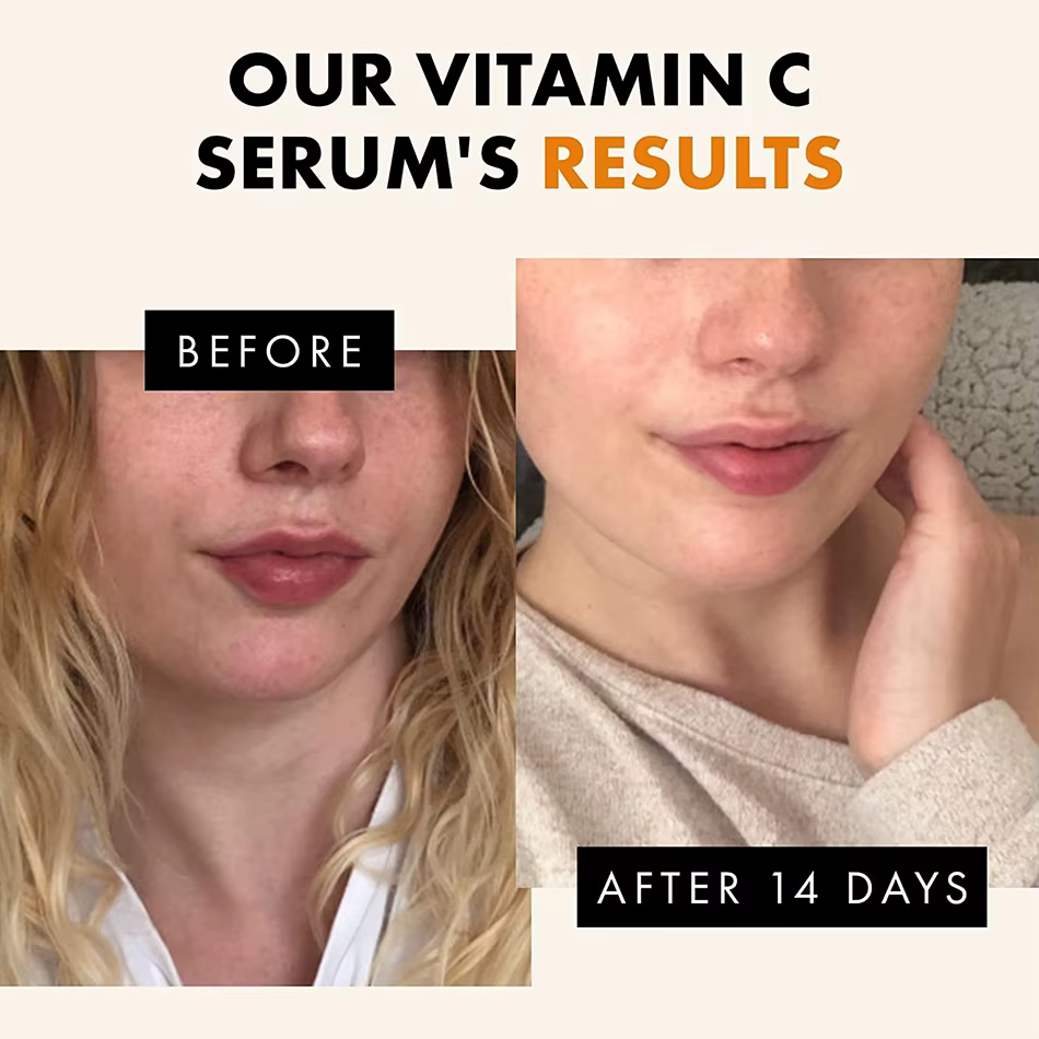 Sérum pour le visage, huile de vitamine C