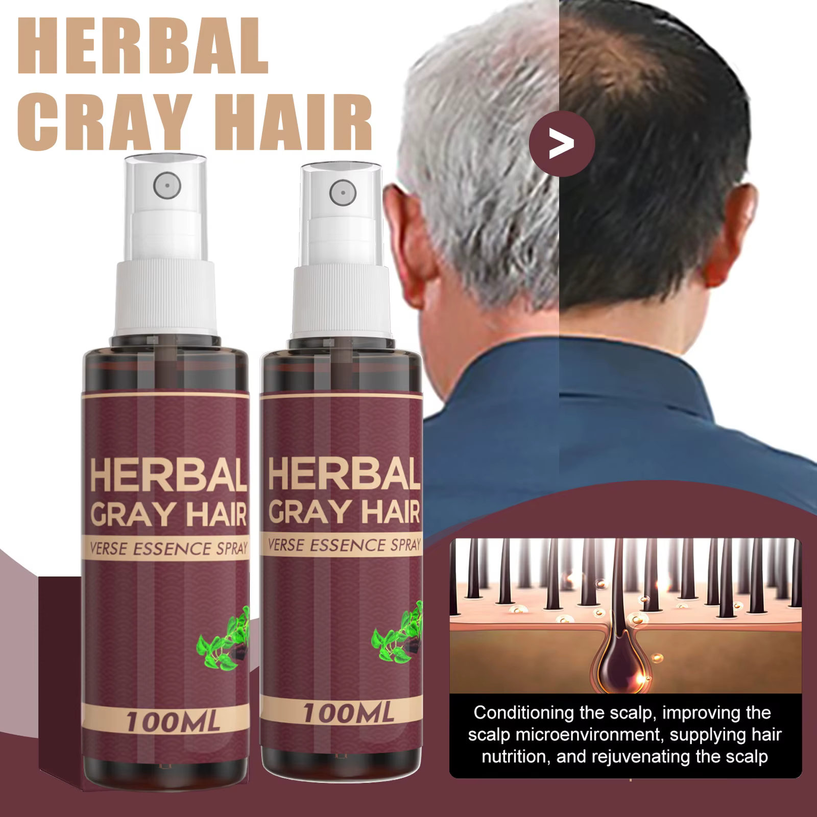 Polygonum Multiflorum cuir chevelu sérum Essence Spray gris/blanc dos au