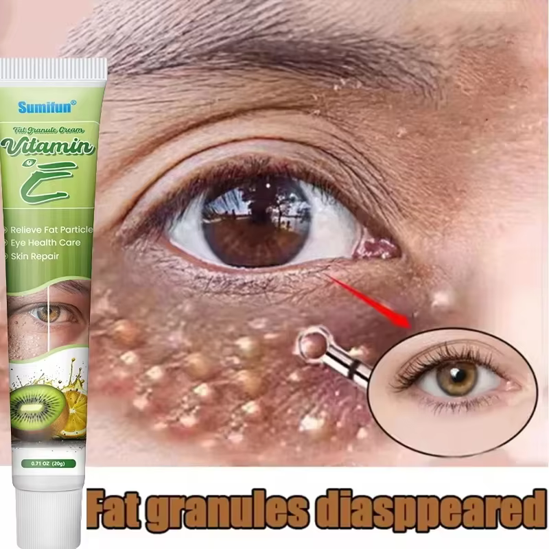 Dissolvant de granulés de graisse crème pour les yeux efficace élimine