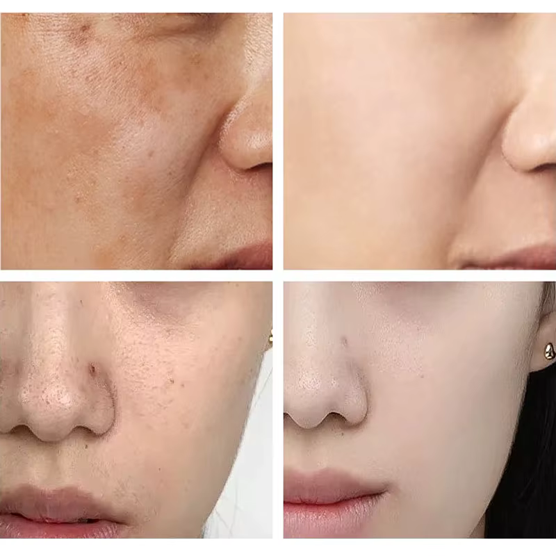 + crème solaire coréenne blanchissante pour le visage