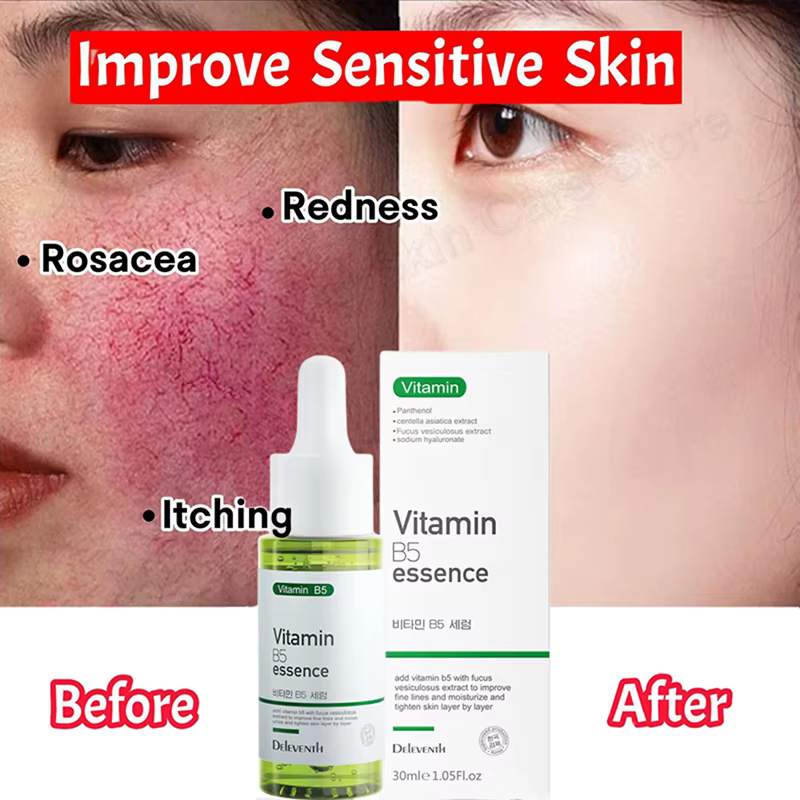 Sérum Réparateur Anti-Rougeurs Visage – Améliore la Peau Sensible et la Sécheresse – Hydratant Apaisant – Élimine la Rosacée – Cosmétiques Coréens