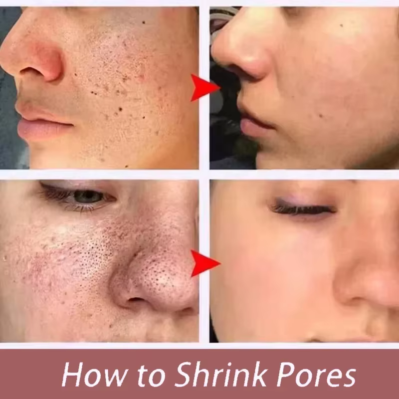 Sérum Coréen Resserre les Pores