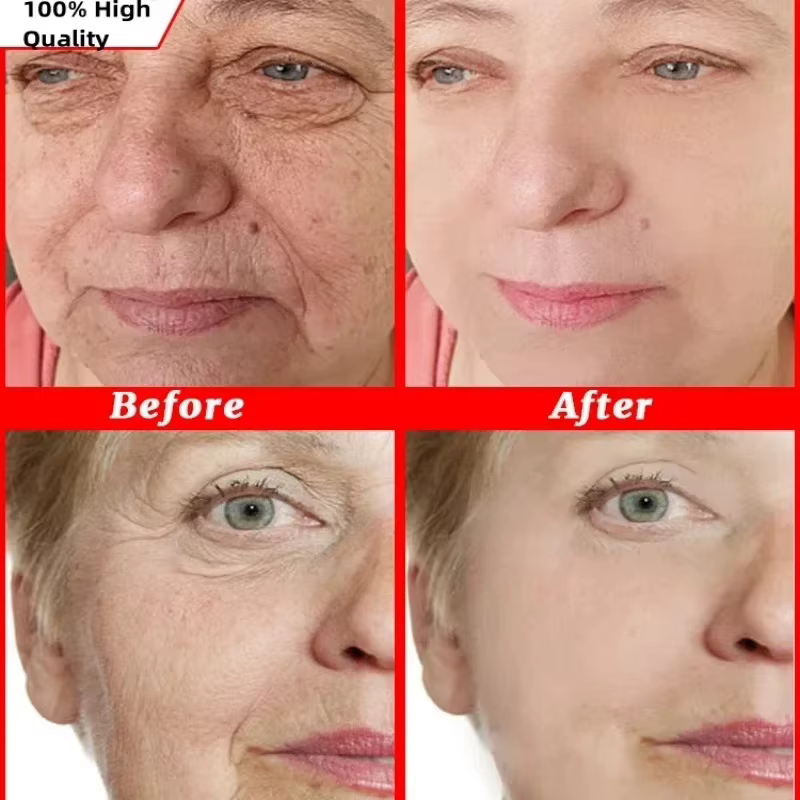 Crème Visage Anti-Âge Instantanée Anti-Rides, Raffermissante, Liftante, Atténue les Ridules, Éclaircissante, Hydratante, Illuminatrice, Resserre la Peau