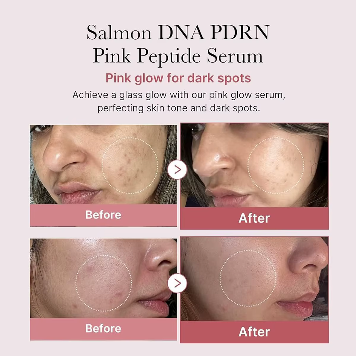 Sérum peptidique rose Medicube Salmon DNA PDRN