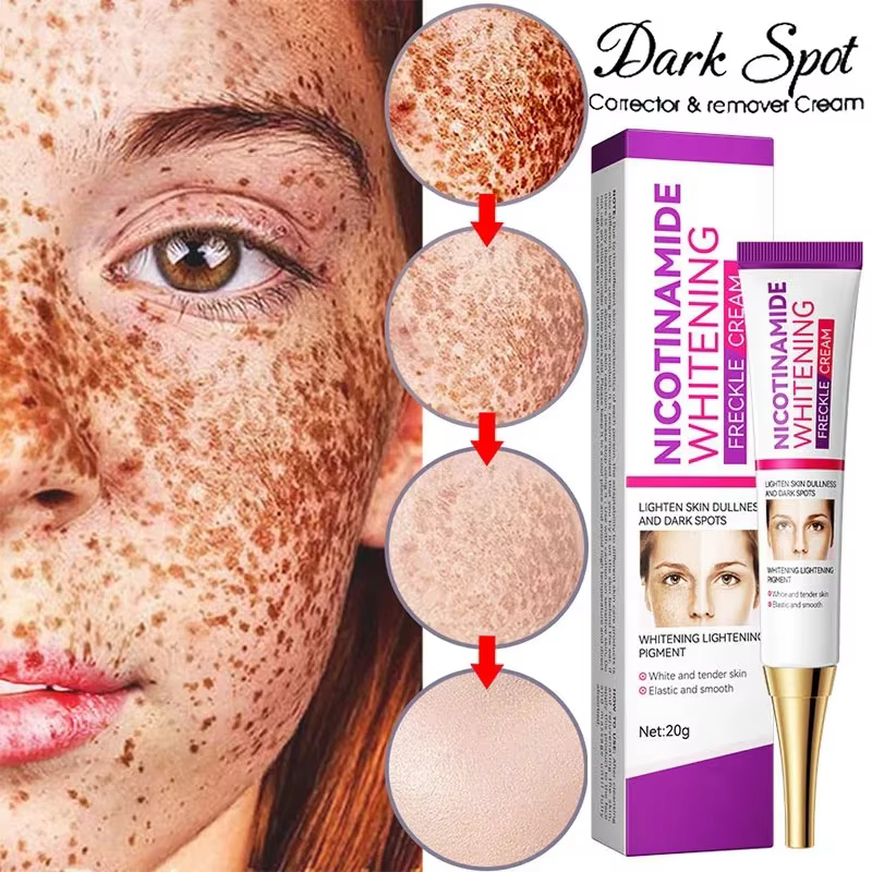 Crème éclaircissante douce à la niacinamide pour la peau