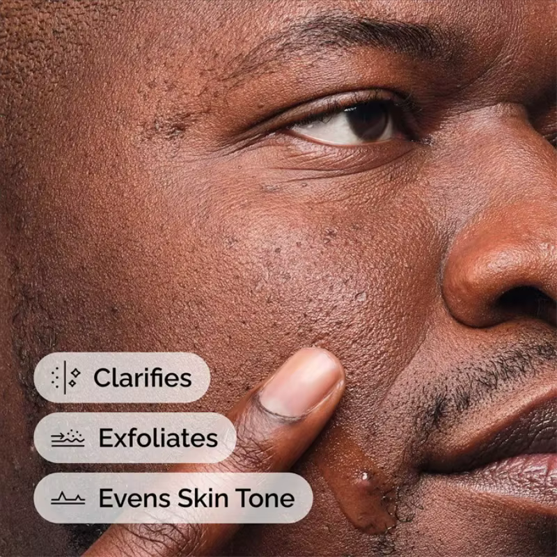 Solution Anhydre à 2% d'Acide Salicylique 30ml – Élimine les Impuretés et la Saleté de la Peau